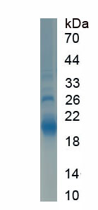 Eukaryotic Chromogranin A (CHGA)