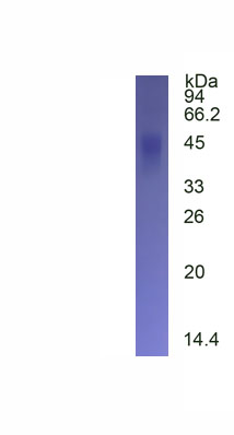 Eukaryotic Fc Fragment Of IgG Low Affinity IIIa Receptor (FcgR3A)
