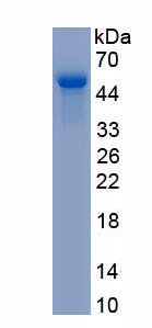 Eukaryotic Cathepsin D (CTSD)