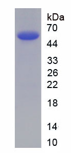 Eukaryotic V-Fos FBJ Murine Osteosarcoma Viral Oncogene Homolog (FOS)