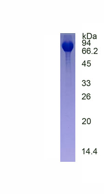 Eukaryotic Acid Sphingomyelinase (ASM)