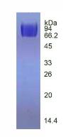 Eukaryotic Vascular Endothelial Growth Factor Receptor 2 (VEGFR2)