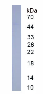 Eukaryotic Serpin B3 (SERPINB3)