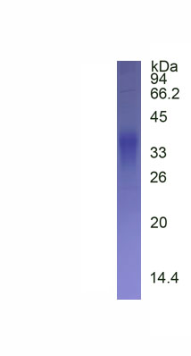 Eukaryotic Cluster of Differentiation 79B (CD79B)