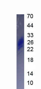 Eukaryotic Cluster Of Differentiation 99 (CD99)