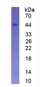 Eukaryotic Cluster Of Differentiation 23 (CD23)