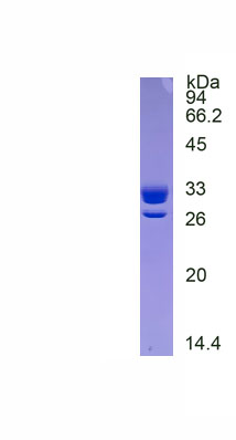 Eukaryotic Integrin Alpha M (CD11b)