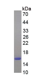 Eukaryotic Fatty Acid Binding Protein 4 (FABP4)