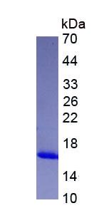 Eukaryotic Fatty Acid Binding Protein 4 (FABP4)