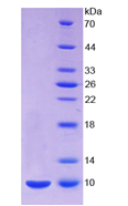 Eukaryotic S100 Calcium Binding Protein A8 (S100A8)