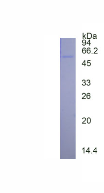 Eukaryotic Vascular Endothelial Growth Factor Receptor 1 (VEGFR1)