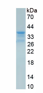 Eukaryotic Syndecan 1 (SDC1)