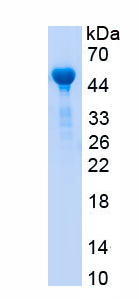 Eukaryotic Endothelin Receptor B (ETRB)
