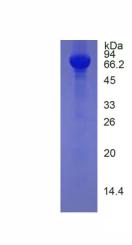 Eukaryotic Histidine Rich Glycoprotein (HRG)