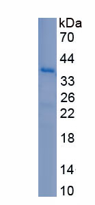 Eukaryotic Insulin Like Growth Factor Binding Protein 5 (IGFBP5)