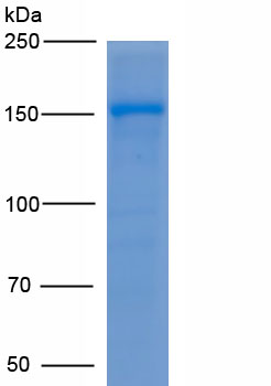 Eukaryotic Nibrin (NBN)