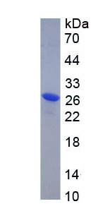 Eukaryotic Progestagen Associated Endometrial Protein (PAEP)