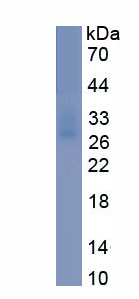 Eukaryotic Perilipin 1 (PLIN1)