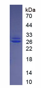 Eukaryotic Fibroblast Growth Factor 21 (FGF21)