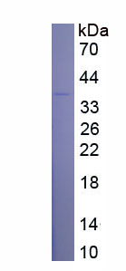 Eukaryotic Fibrinogen Like Protein 1 (FGL1)