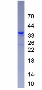 Eukaryotic Fibrinogen Like Protein 1 (FGL1)