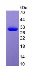 Eukaryotic Green Fluorescent Protein (GFP)