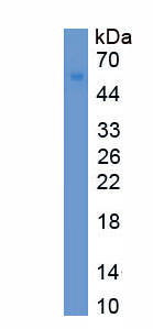 Eukaryotic Sjogren Syndrome Antigen B (SSB)