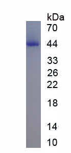 Eukaryotic Neurofilament, Heavy Polypeptide (NEFH)