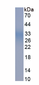 Eukaryotic Ephrin B2 (EFNB2)