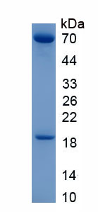 Eukaryotic Proprotein Convertase Subtilisin/Kexin Type 9 (PCSK9)