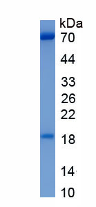Eukaryotic Proprotein Convertase Subtilisin/Kexin Type 9 (PCSK9)