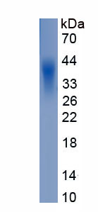 Eukaryotic Sodium Dependent Dicarboxylate Cotransporter 3 (NADC3)
