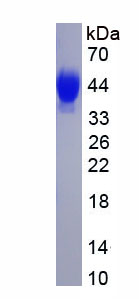 Eukaryotic Regenerating Islet Derived Protein 1 Beta (REG1b)