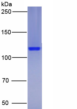 Eukaryotic Interleukin 23 Receptor (IL23R)