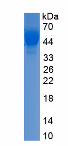 Eukaryotic Poly/rC Binding Protein 1 (PCBP1)