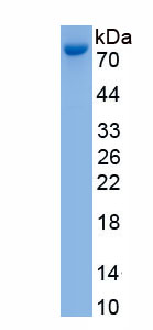 Eukaryotic Phosphodiesterase 5A, cGMP Specific (PDE5A)