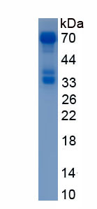Eukaryotic Sex Determining Region Y Box Protein 9 (SOX9)