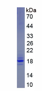 Eukaryotic Signaling Threshold Regulating Transmembrane Adaptor 1 (SIT1)