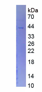 Eukaryotic Glucose-6-Phosphatase, Catalytic (G6PC)