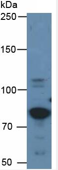 Eukaryotic Tu Translation Elongation Factor, Mitochondrial (tUFM)