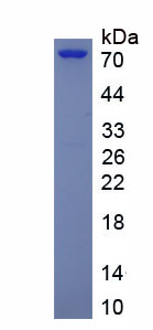 Eukaryotic A Disintegrin And Metalloprotease 12 (ADAM12)