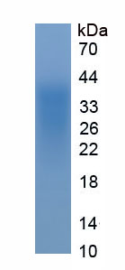 Eukaryotic Single Ig IL1 Related Receptor (SIGIRR)