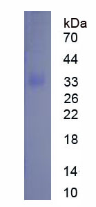 Eukaryotic Short Palate, Lung And Nasal Epithelium Carcinoma Associated Protein 2 (SPLUNC2)