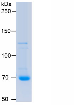 Eukaryotic PAI-1/tPA Complex (tPA/PAI1)