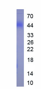 Eukaryotic Nucleoprotein, SARS-CoV (NP)