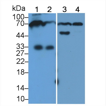 HRP-Linked Polyclonal Antibody to Immunoglobulin M (IgM)