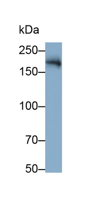 Monoclonal Antibody to Angiotensin I Converting Enzyme (ACE)