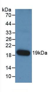 Monoclonal Antibody to Angiopoietin 1 (ANGPT1)