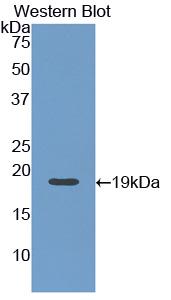 Monoclonal Antibody to Angiopoietin 1 (ANGPT1)