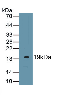 Monoclonal Antibody to Endothelial protein C receptor (EPCR)